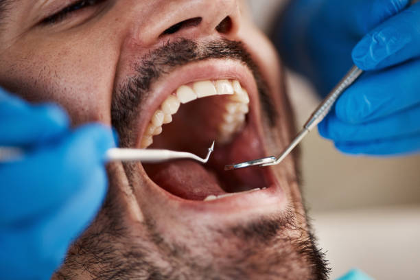 Full Mouth Reconstruction in Bedford, OH